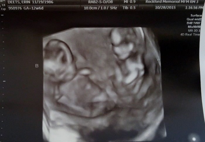 13 weken zwanger van een tweeling