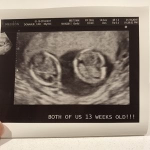 13 Weeks Pregnant with Twins: Tips, Advice & How to Prep - Twiniversity