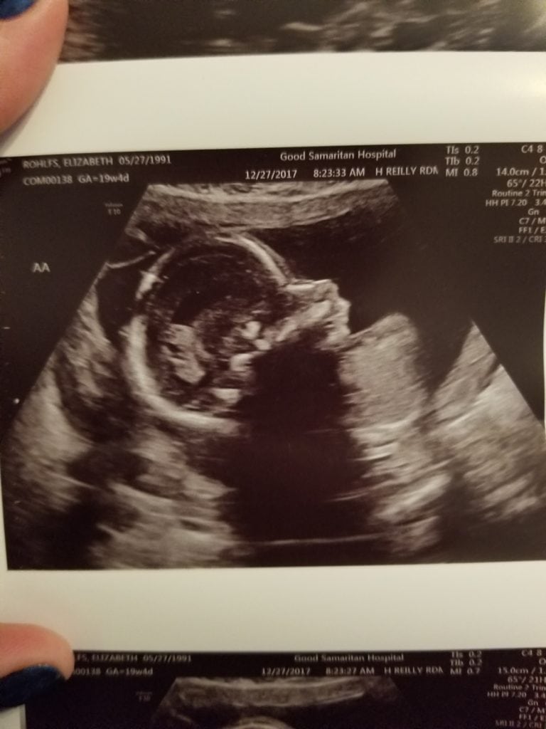 19 weeks pregnant and having flutter in chest