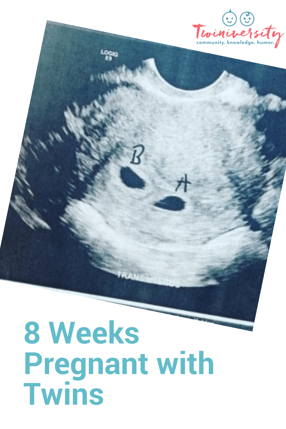 8 Weeks Pregnant With Twins - Twiniversity