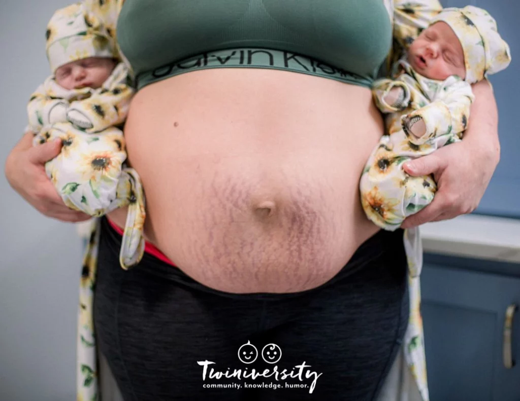 Postpartum twin belly with babies by her side