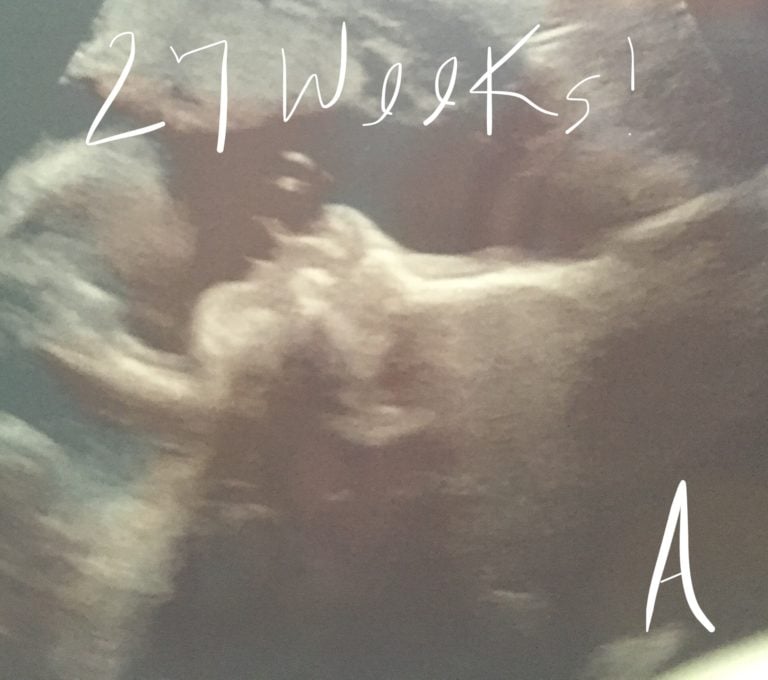 27 Weeks Pregnant With Twins Tips Advice And How To Prep Twiniversity