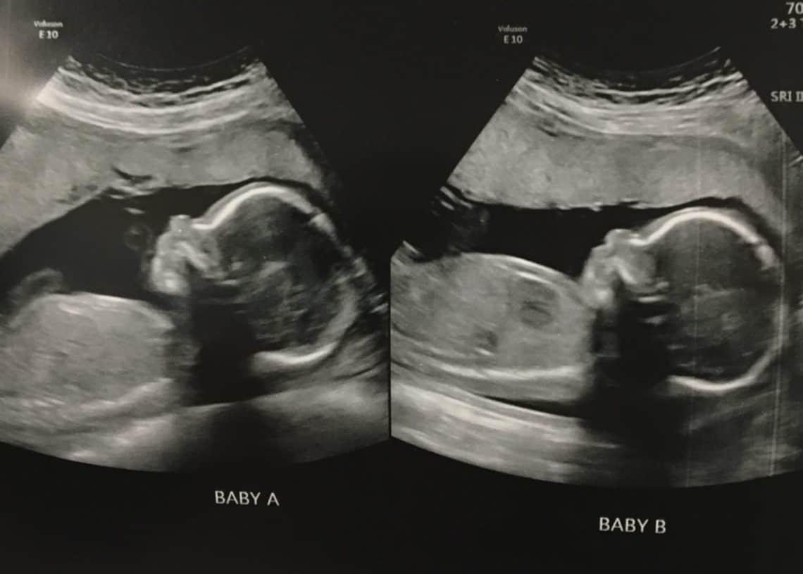 30 weeks 4d ultrasound pictures