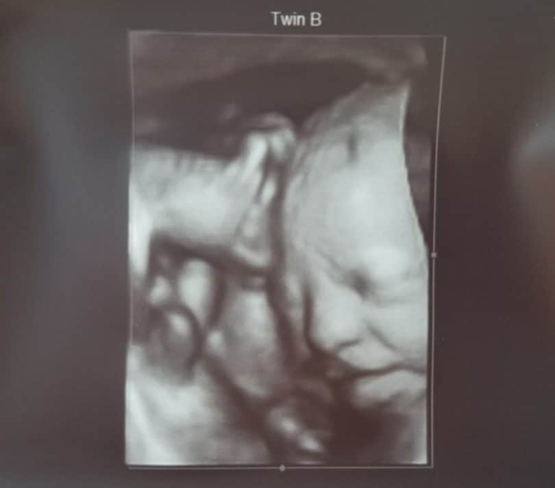 30 weeks pregnant 3d ultrasound