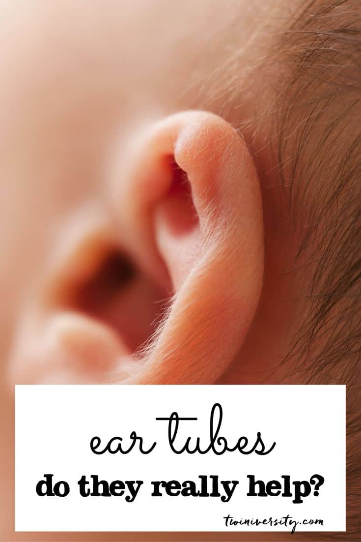 What to Expect with Ear Tubes Surgery for Kids - Twiniversity