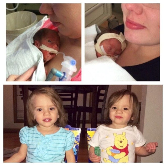 A Beautiful Gallery Of Preemie Twins: Before And After! - Twiniversity