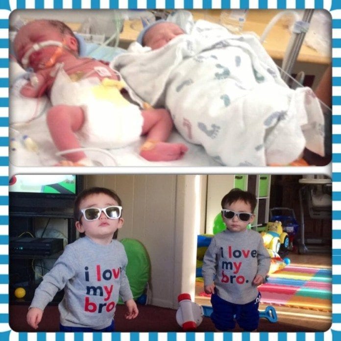 A Beautiful Gallery Of Preemie Twins Before And After Twiniversity