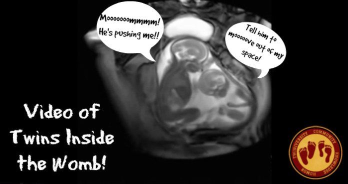 Video Of Twins Inside The Womb Twiniversity 